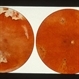 Posterior Uveitis